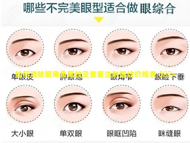 如何消除眼角鱼尾纹及查看注射眼纹价格表 🌻